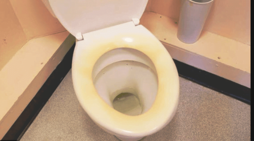 How to Remove Yellow Stains On A Toilet Seat