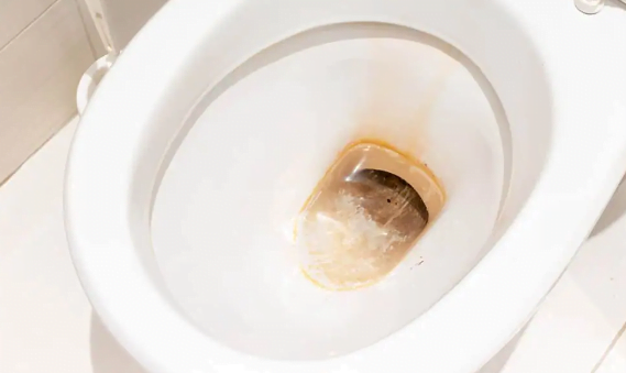What Causes Brown Stains In Toilet Bowls?