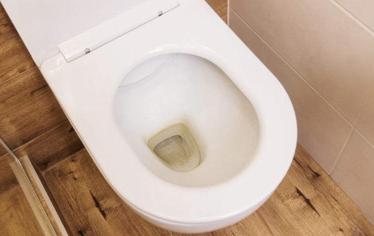why is my toilet water yellow