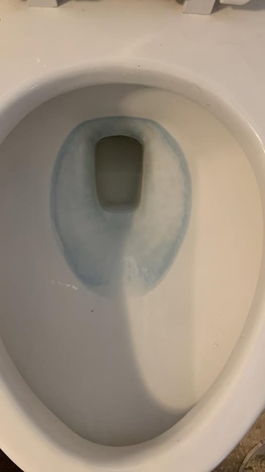 How to Remove Blue Toilet Bowl Cleaner Stains